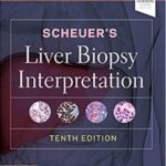 Liver Biopsy Interpretation Scheuer`s - 2021
