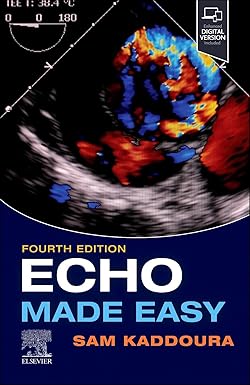 9780702083600.jpg Echo Made Easy - 2025 - تصویر 1