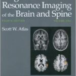 Magnetic Resonance Imaging of the Brain and Spine - 2 Vol - 2009