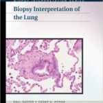 Biopsy Interpretation of the Lung - 2013