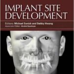 Implant Site Development - 2012