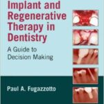 Implant and Regenerative Therapy in Dentistry: A Guide to Decision Making - 2009