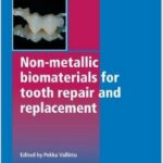 Non-Metallic Biomaterials for Tooth Repair and Replacement (Woodhead Publishing Series in Biomaterials - 2013