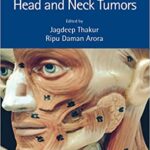 Operative Surgery for Head and Neck Tumors - 2022