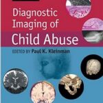 Diagnostic Imaging of Child Abuse - 2015