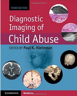 9781107010536.jpg Diagnostic Imaging of Child Abuse - 2015 - تصویر 1