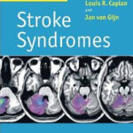Stroke Syndromes - 2012