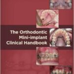 The Orthodontic Mini-implant Clinical Handbook - 2013