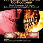 Orthodontically Driven Corticotomy: Tissue Engineering to Enhance Orthodontic and Multidisciplinary Treatment - 2015