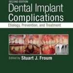 Dental Implant Complications: Etiology, Prevention, and Treatment - 2016