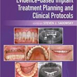 Evidence-based Implant Treatment Planning and Clinical Protocols - 2017