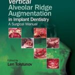 Vertical Alveolar Ridge Augmentation in Implant Dentistry: A Surgical Manual - 2016