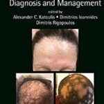 Hair Disorders: Diagnosis and Management (Series in Dermatological Treatment - 2022