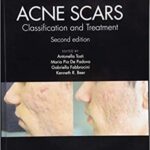 Acne Scars: Classification and Treatment - 2019