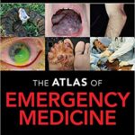 Atlas of Emergency Medicine Knoop - 2021