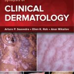 Color Atlas and Synopsis of Clinical Dermatology Fitzpatrick`s - 2023