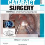 Cataract Surgery - 2010