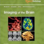 Imaging of the Brain: Expert Radiology Series - 2013