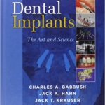 Dental Implants: The Art and Science - 2011