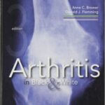 Arthritis in Black and White - 2012