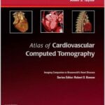 Atlas of Cardiovascular Computed Tomography: Imaging Companion to Braunwald`s Heart Disease - 2010