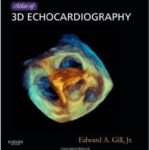 Atlas of 3D Echocardiography - 2013