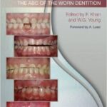 Toothwear: The ABC of the Worn Dentition - 2011