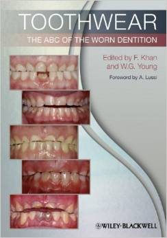 9781444336559.jpg Toothwear: The ABC of the Worn Dentition - 2011 - تصویر 1