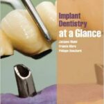 Implant Dentistry at a Glance - 2012