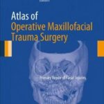 Atlas of Operative Maxillofacial Trauma Surgery: Primary Repair of Facial Injuries - 2014