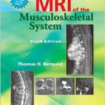 MRI of the Musculoskeletal System - 2013