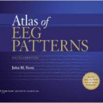 Atlas of EEG Patterns - 2013