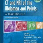 CT & MRI of the Abdomen and Pelvis: A Teaching File - 2014