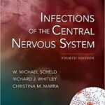 Infections of the Central Nervous System - 2014