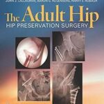 The Adult Hip: Hip Preservation Surgery - 2015