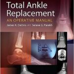 Total Ankle Replacement: An Operative Manual - 2014