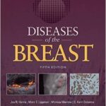 Diseases of the Breast - Harris - 2014
