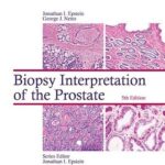 Biopsy Interpretation of the Prostate - 2015