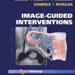 Image-Guided Interventions-2vol - 2014