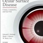 Ocular Surface Disease: Cornea, Conjunctiva and Tear Film - 2013