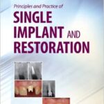 Principles and Practice of Single Implant and Restoration- Torabnejad - 2014