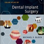 Color Atlas of Dental Implant Surgery - 2015