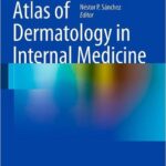 Atlas of Dermatology in Internal Medicine - 2012