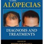 The Alopecias: Diagnosis and Treatments +VIDEO - 2016