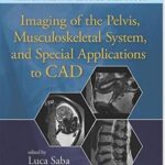 Imaging of the Pelvis, Musculoskeletal System, and Special Applications to CAD - 2016
