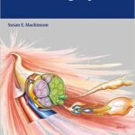 Nerve Surgery - 2015