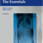 Spinal Deformities: The Essentials - 2014