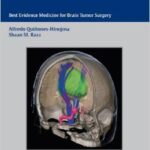 Controversies in Neuro-Oncology: Best Evidence Medicine for Brain Tumor Surgery - 2014