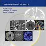 Neuroradiology: The Essentials with MR and CT - 2015