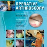 Operative Arthroscopy - 2013